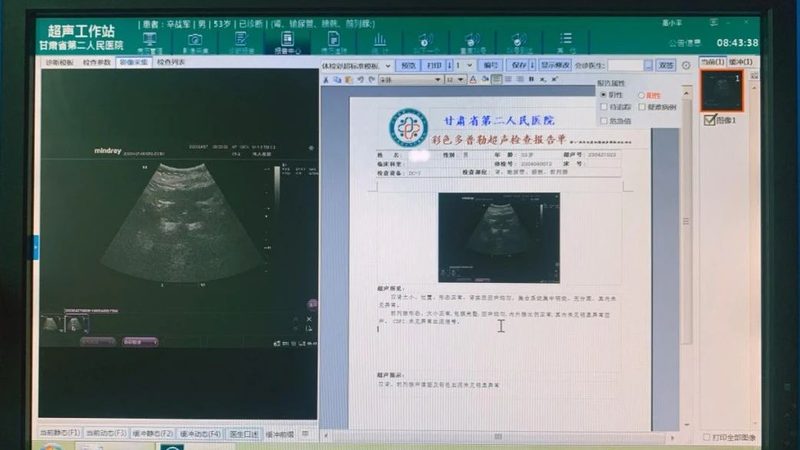 体检报告解读与医生咨询的区别
